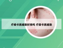 疗癣卡西甫散好用吗 疗藓卡西甫散