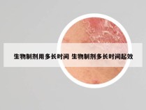 生物制剂用多长时间 生物制剂多长时间起效