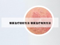 银屑治疗较好方法 银屑治疗有效方法