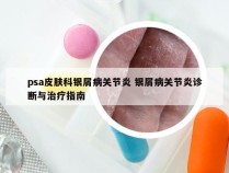 psa皮肤科银屑病关节炎 银屑病关节炎诊断与治疗指南