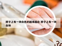 脖子上有一块白色的越来越白 脖子上有一块白块