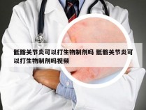 骶髂关节炎可以打生物制剂吗 骶髂关节炎可以打生物制剂吗视频