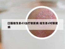 囗服维生素d3治疗银屑病 维生素d对银屑病