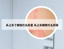 头上长了癣挂什么科室 头上长癣擦什么药膏