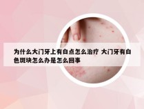 为什么大门牙上有白点怎么治疗 大门牙有白色斑块怎么办是怎么回事