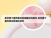 南京哪个医院看皮肤病最好的医院 南京那个医院看皮肤病比较好