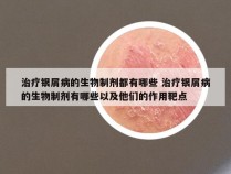 治疗银屑病的生物制剂都有哪些 治疗银屑病的生物制剂有哪些以及他们的作用靶点