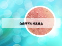 白癜风可以喝黑糖水