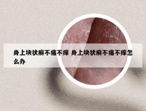 身上块状癣不痛不痒 身上块状癣不痛不痒怎么办