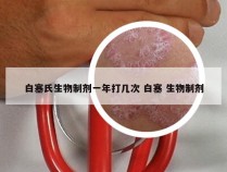 白塞氏生物制剂一年打几次 白塞 生物制剂