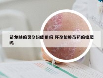 苗龙肤癣灵孕妇能用吗 怀孕能擦苗药癣痒灵吗