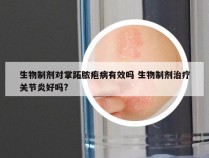 生物制剂对掌跖脓疱病有效吗 生物制剂治疗关节炎好吗?