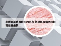 新疆银屑病医院招聘信息 新疆银屑病医院招聘信息最新