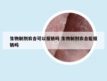 生物制剂农合可以报销吗 生物制剂农合能报销吗