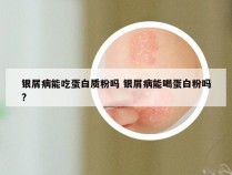 银屑病能吃蛋白质粉吗 银屑病能喝蛋白粉吗?