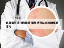 银屑病可以打胸腺肽 银屑病可以吃胸腺肽肠溶片