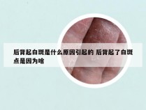 后背起白斑是什么原因引起的 后背起了白斑点是因为啥