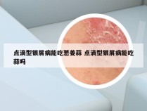 点滴型银屑病能吃葱姜蒜 点滴型银屑病能吃蒜吗