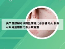 关节皮肤癣可以擦盐酸特比萘芬乳膏么 股癣可以用盐酸特比萘芬喷雾剂