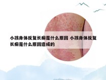 小孩身体反复长癣是什么原因 小孩身体反复长癣是什么原因造成的