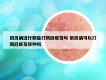 银屑病进行期能打新冠疫苗吗 银屑病可以打新冠疫苗接种吗