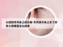 小孩到冬天身上就长癣 冬天孩子身上长了好多小疙瘩是怎么回事