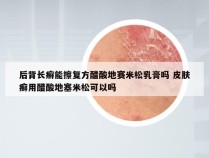 后背长癣能擦复方醋酸地赛米松乳膏吗 皮肤癣用醋酸地塞米松可以吗