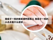 像痱子一样的银屑病咋回事儿 像痱子一样的小点点是什么症状