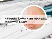 4岁小女孩脸上一块白一块白 四岁女孩脸上一块白一块白怎么回事