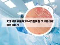 天津银屑病医院津74门医院看 天津最权威银屑病医院