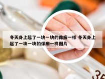 冬天身上起了一块一块的像癣一样 冬天身上起了一块一块的像癣一样图片