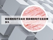 银屑病排毒疗法自愈 银屑病排毒疗法自愈要多久