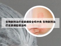 生物制剂治疗皮肤病安全吗中央 生物制剂治疗皮肤病能根治吗