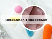 小孩腰间长癣怎么办 小孩腰间长癣怎么办啊