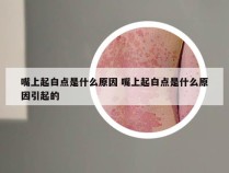 嘴上起白点是什么原因 嘴上起白点是什么原因引起的