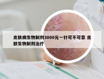 皮肤病生物制剂3000元一针可不可靠 皮肤生物制剂治疗