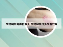 生物制剂需要打多久 生物制剂打多久有效果