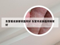 东营看皮肤那家医院好 东营市皮肤医院哪家好