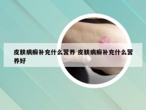 皮肤病癣补充什么营养 皮肤病癣补充什么营养好