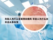 年轻人为什么容易得白癜风 年轻人为什么会长这么多白发