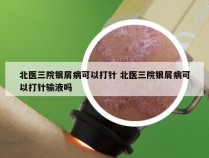 北医三院银屑病可以打针 北医三院银屑病可以打针输液吗