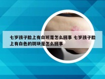 七岁孩子脸上有白班是怎么回事 七岁孩子脸上有白色的斑块是怎么回事