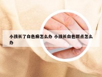 小孩长了白色癣怎么办 小孩长白色斑点怎么办