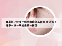 身上长了好多一块块的癣怎么回事 身上长了好多一块一块的像癣一样斑