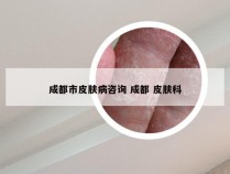 成都市皮肤病咨询 成都 皮肤科