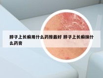 脖子上长癣用什么药擦最好 脖子上长癣抹什么药膏