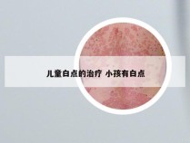 儿童白点的治疗 小孩有白点