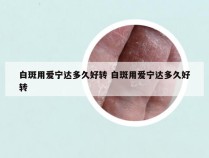 白斑用爱宁达多久好转 白斑用爱宁达多久好转