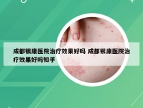 成都银康医院治疗效果好吗 成都银康医院治疗效果好吗知乎