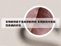 生物制剂属于免疫抑制剂吗 生物制剂对免疫性疾病的好处